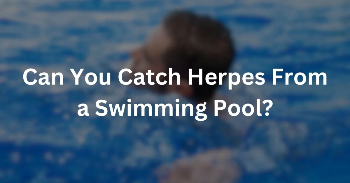 can you catch herpes from swimming pool